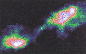 Jets
in star formation